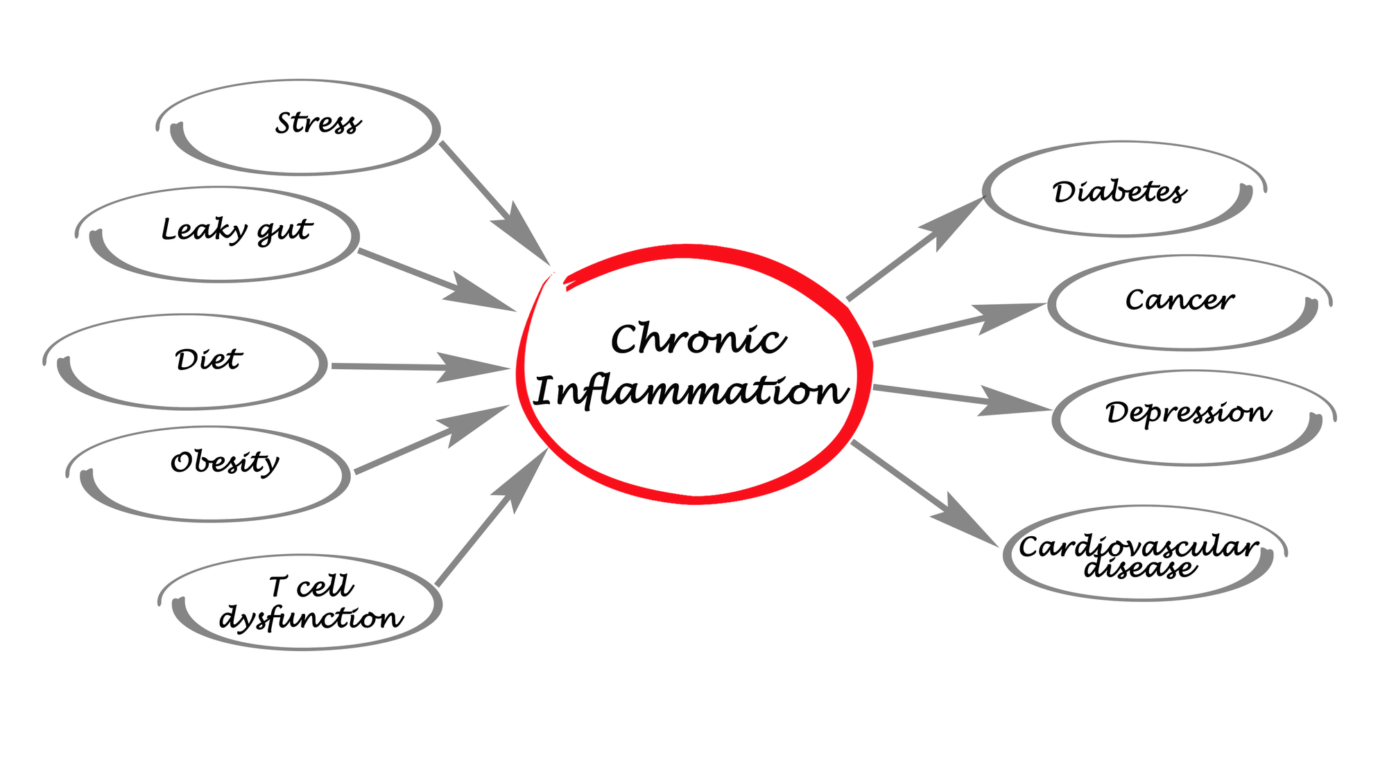 Diagram of IBS Symptoms